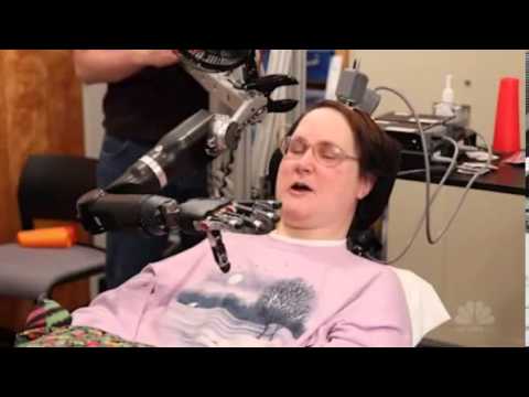 A paralyzed woman has been able to control a robotic prosthetic hand using her thoughts.