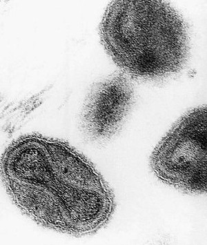 A micrograph of the smallpox virus.