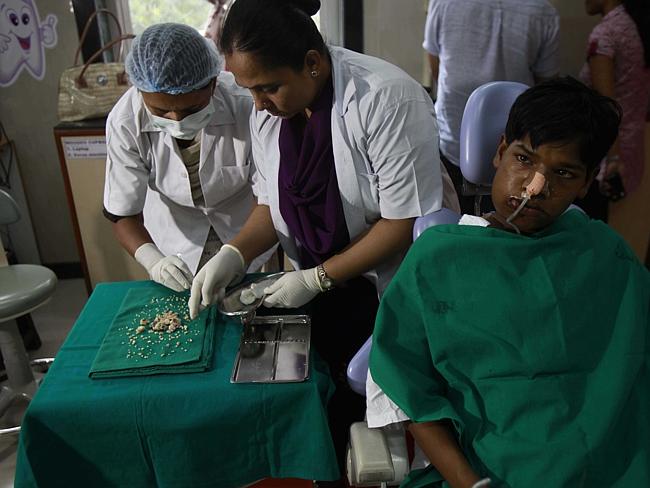 Major discomfort ... Dentists count the teeth they pulled from a tumour in Ashique Gavai’