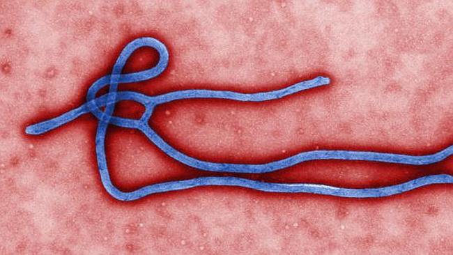 A close-up of the ebola virus.