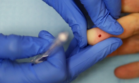 Blood being tested for HIV.