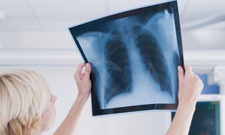 A nurse looking at an x-ray