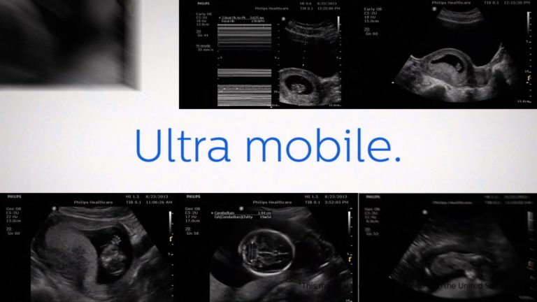 Philips VISIQ Tablet Ultrasound Now Cleared in U.S. (VIDEO)