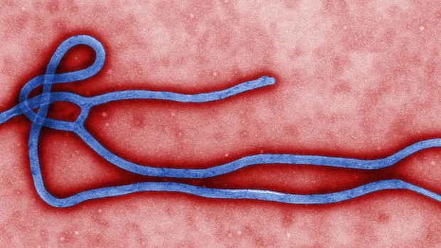 The ebola virus, which has killed nearly 700 people in west Africa.