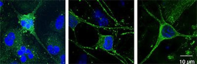 Neurochemical imbalance in schizophrenia discovered