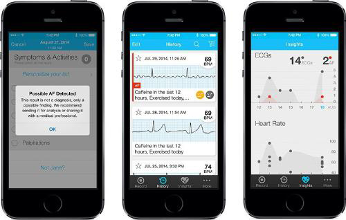 AliveCor new app AliveCor Heart Monitor App with Automatic AFib Detection Now Available