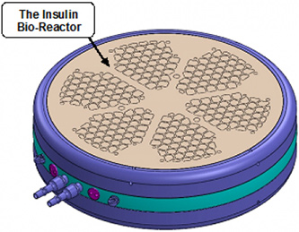 insulin bio reactor ßAir Bio Artificial Pancreas May Finally Treat Type 1 Diabetes