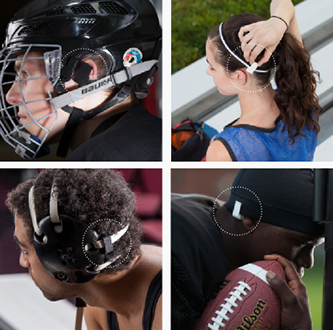 jolt Jolt Sensor Allows for Real Time Sports Head Impact Assessment