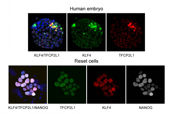 Stem cells figure-3