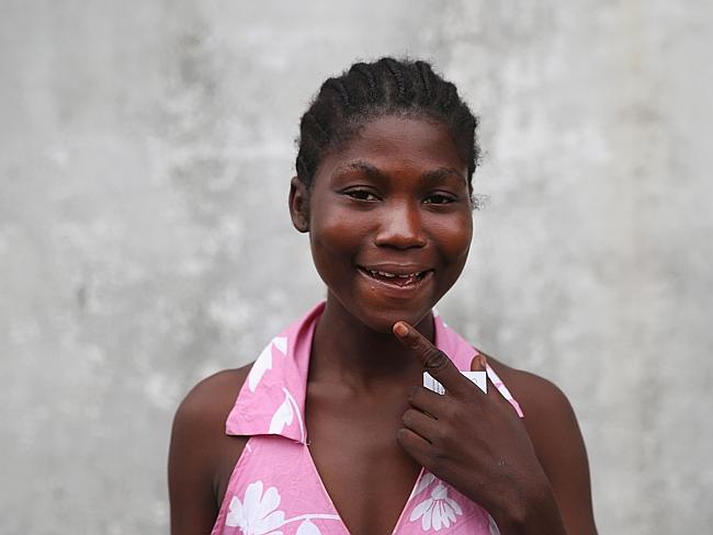 Nancy Paye, 20, stands outside the centre where she was treated after she got the disease