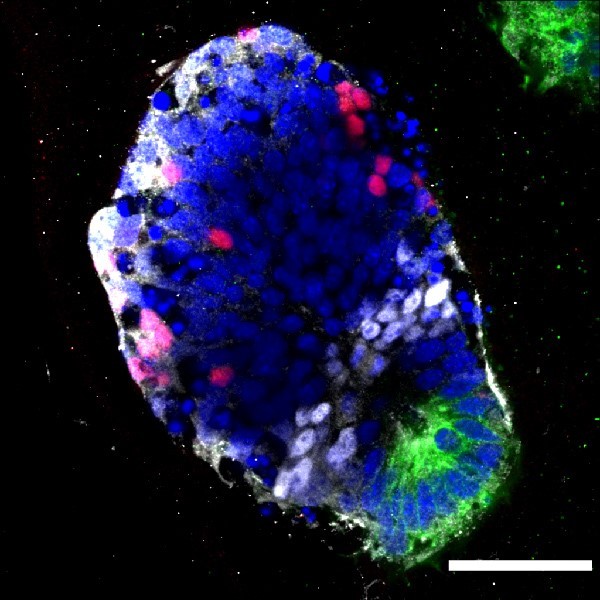 Reconstruction of patterned piece of spinal cord in 3D culture