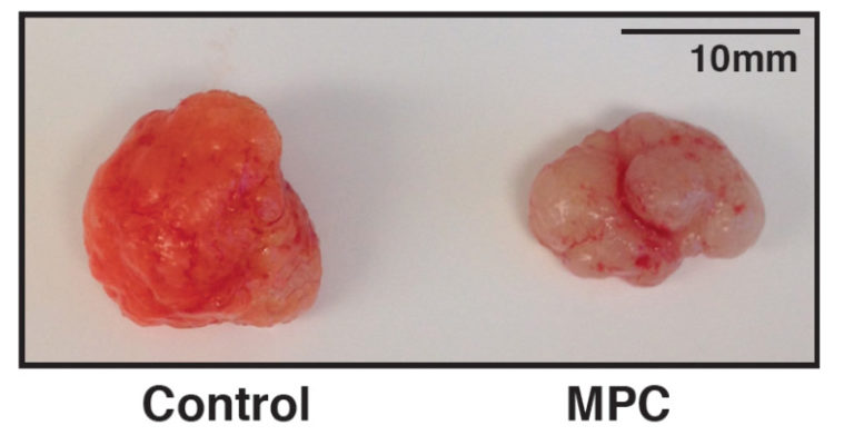 Rewiring metabolism slows colorectal cancer growth