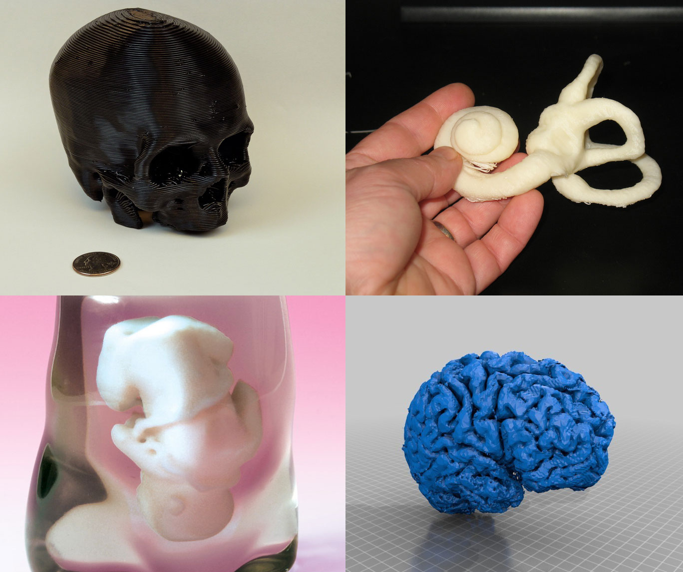 These are just a few of the many types of body parts that have been successfully designed using 3-D printing technology.