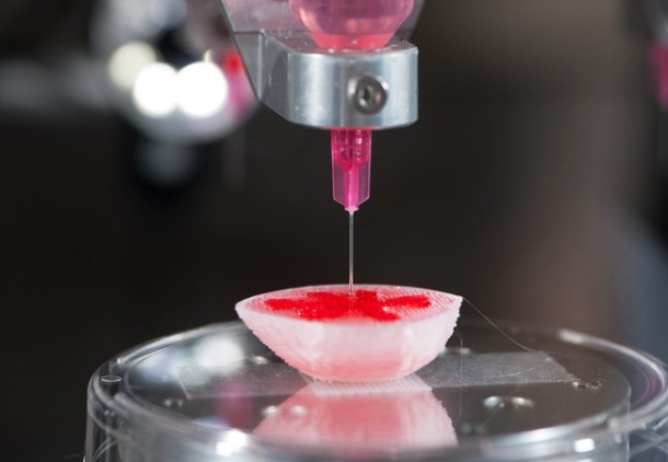 Above, a 3-D printer is shown in the process of printing a human kidney. 