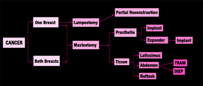 The decision-tree above is designed to help breast cancer patients choose the best type of breast reconstruction surgery for their individual needs and preferences.