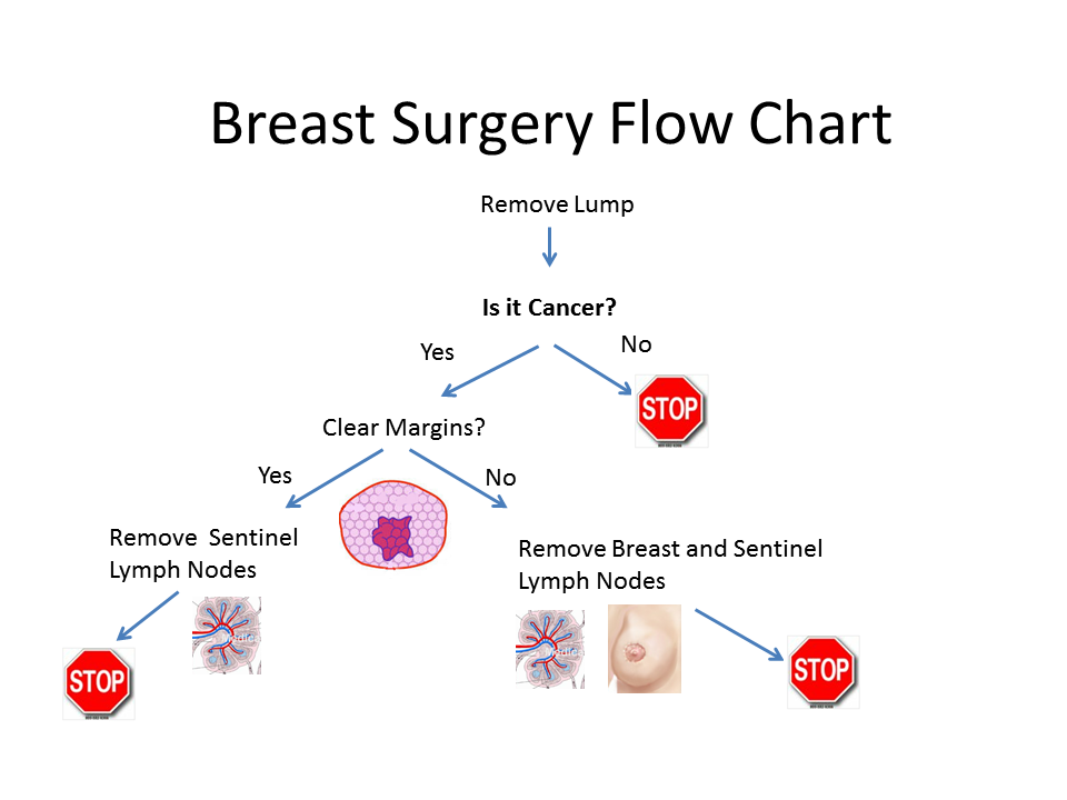 A decision-tree like the one pictured above can be used to aid treatment decisions after diagnosis and staging of breast cancer.