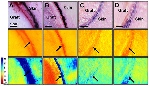 graft Phosphorescent Transparent Paint On Bandage Shows Wound Tissue Oxygenation