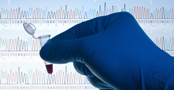 HIV_ Genome_ Vacc