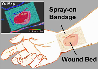 spray on bandage Phosphorescent Transparent Paint On Bandage Shows Wound Tissue Oxygenation