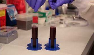 tlp coating Bioinspired Blood and Bacteria Repellent Coating for Medical Devices (VIDEO)