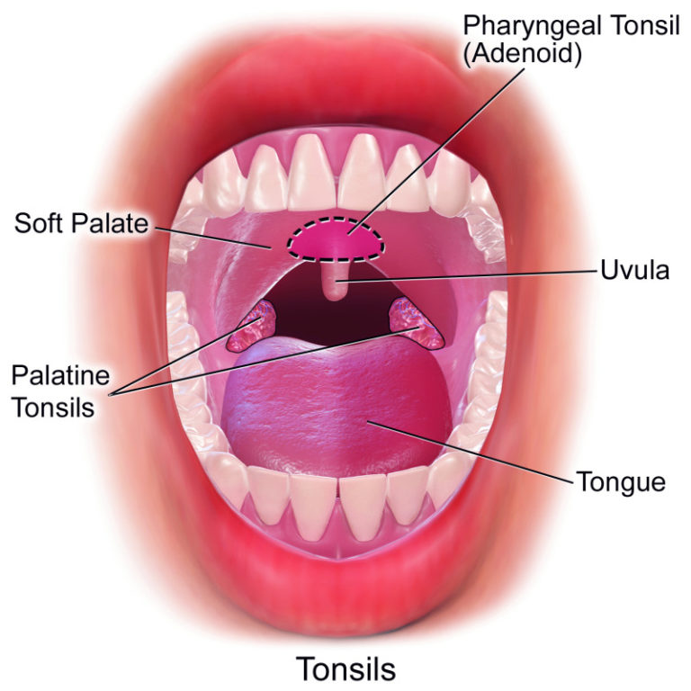 Surgery for sleep apnea improves asthma control