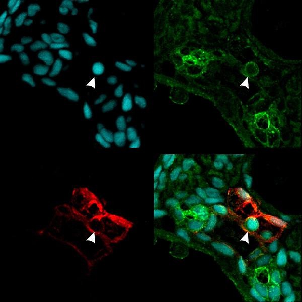 Before there will be blood: Surprising role of protein in embryonic development