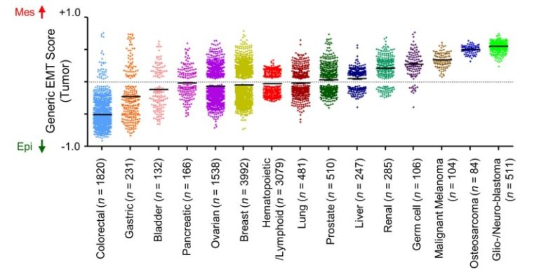 Scoring scheme predicts ability of cancer cells to spread to other parts of body