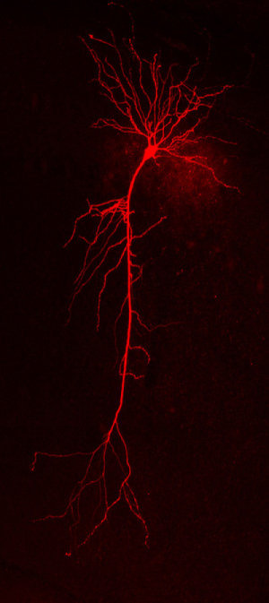 Computer model of nerve cells provides insights into communication problems