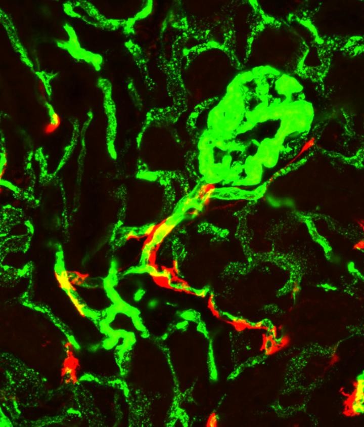 Cellular origin of fibrosis found