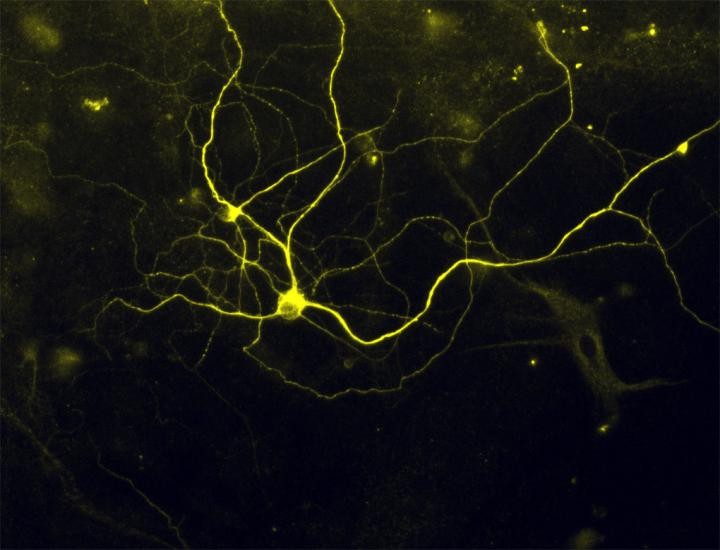 Pain in a dish: Researchers turn skin cells into pain sensing neurons