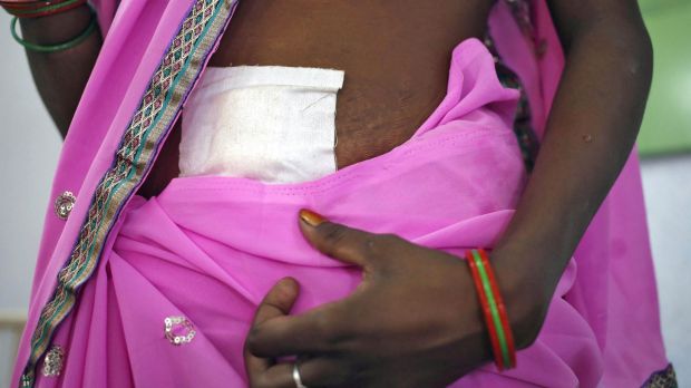 A woman, who underwent sterilisation surgery at a government mass sterilisation "camp", walks in a hospital in Bilaspur, in the eastern Indian state of Chhattisgarh.