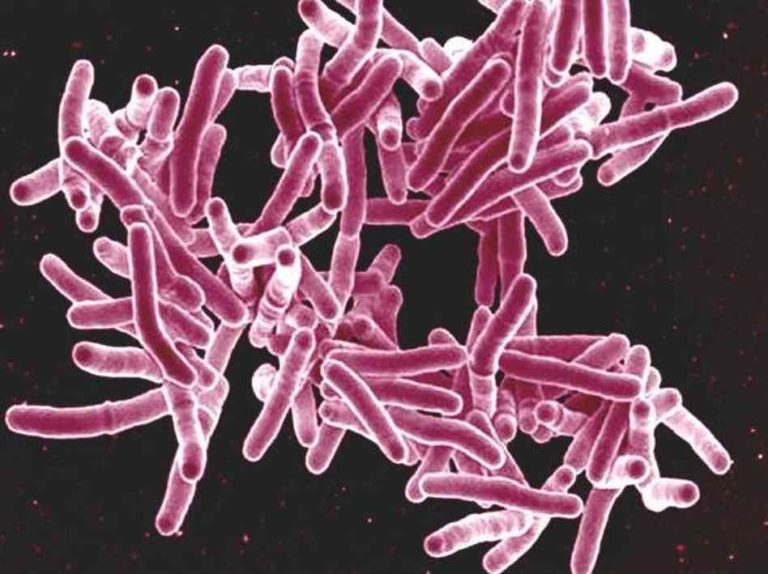 Amid Talk of Ebola, Australia Is Apparently Silencing Discussion of Tuberculosis Threat