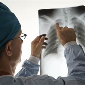 Black lung cases known before disease officially re-emerged