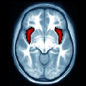 In the latest study, the anterior insula (red) on each side of the brain was smaller in preschool kids diagnosed with depression and those who experienced excessive guilt at early ages. Image credit: Early Emotional Development Program/Washington University in St. Louis