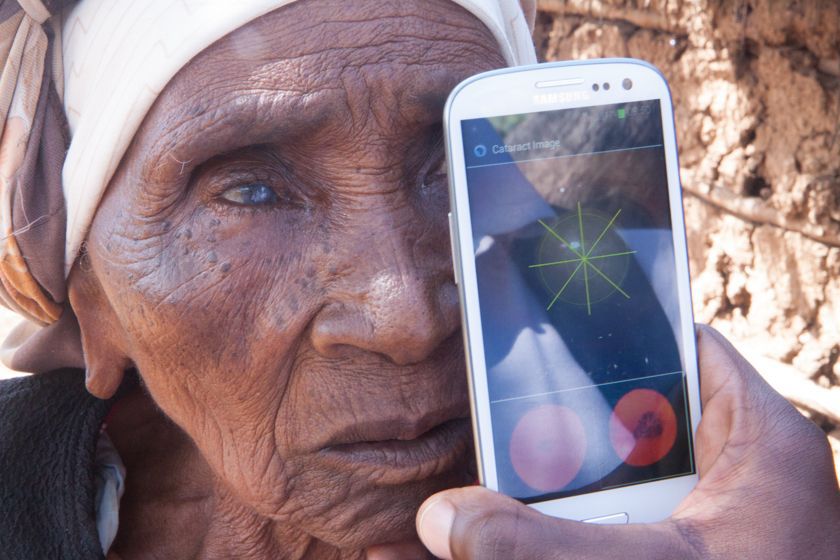 Cataract testing outside patients home