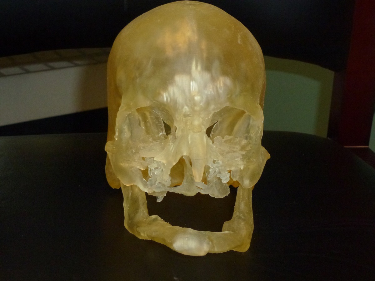 3D printed model of a skull