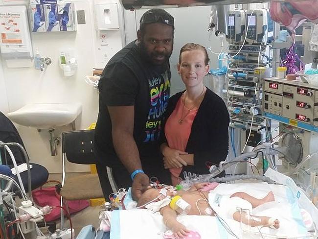 Fighting for life ... Eloise was put on life support at Brisbane’s Mater Hospital under t