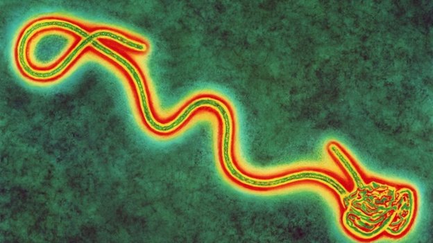 How Long Can Ebola Survive Outside The Human Body? No One Really Knows.