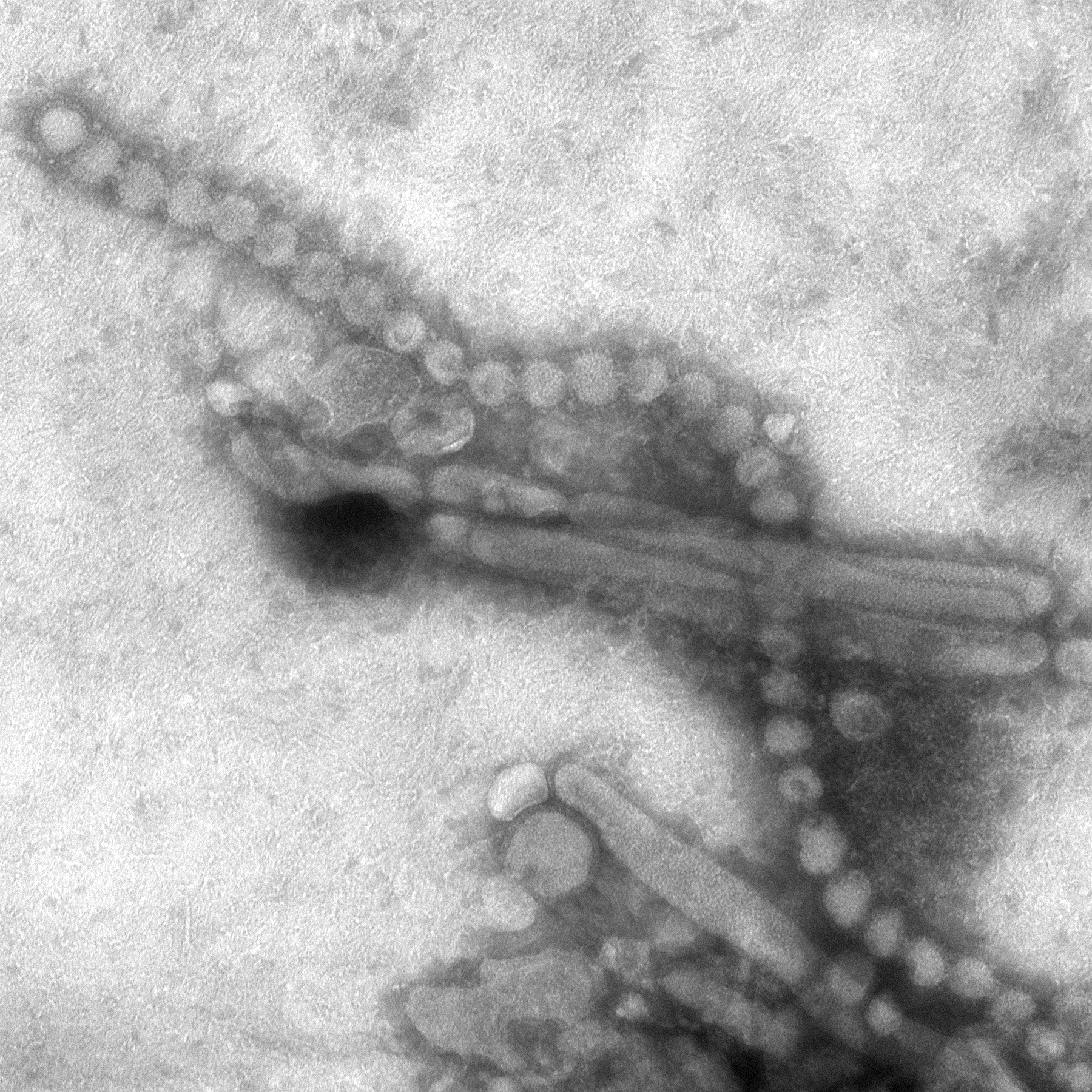 The H7N9 strain of avian flu, seen above in an electron micrograph image, is one of the deadlier strains of 