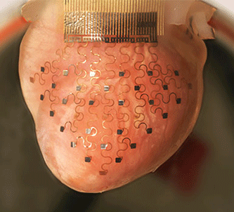 flexible-electronics-heart