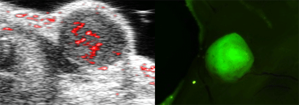 New Multimodal Molecular Imaging Probe for Diagnosing Breast Tumors and Guiding Surgical Resection