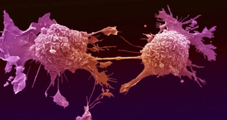 Breast Cancer Vaccine Shows Promise In Small Clinical Trial