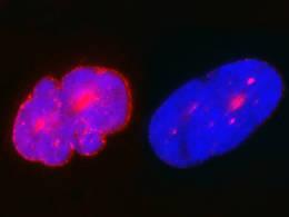 Substance from broccoli can moderate progeria defects