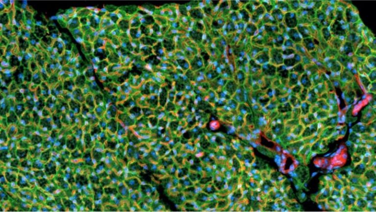 Hacking fat cells’ metabolism does not affect insulin resistance