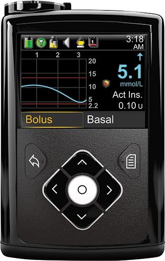 Black_Front_CGM_mmol