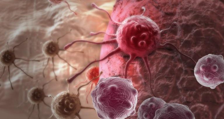 Tumor Biopsies Do Not Promote Cancer Spread, Study Finds