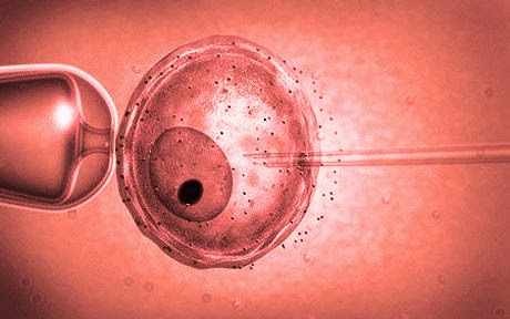 The ins and outs of sperm donation