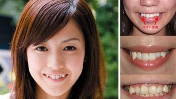 Snaggleteeth and London Gaps: the imperfect teeth trend