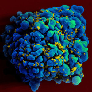 Human immune system can control re-awakened HIV, suggesting cure is possible