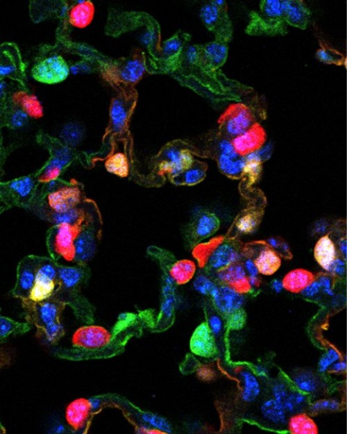 Limber lungs: One type of airway cell can regenerate another lung cell type